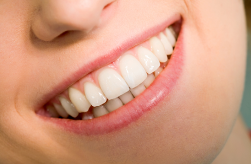 What Are Some of the Benefits of Braces for Teeth