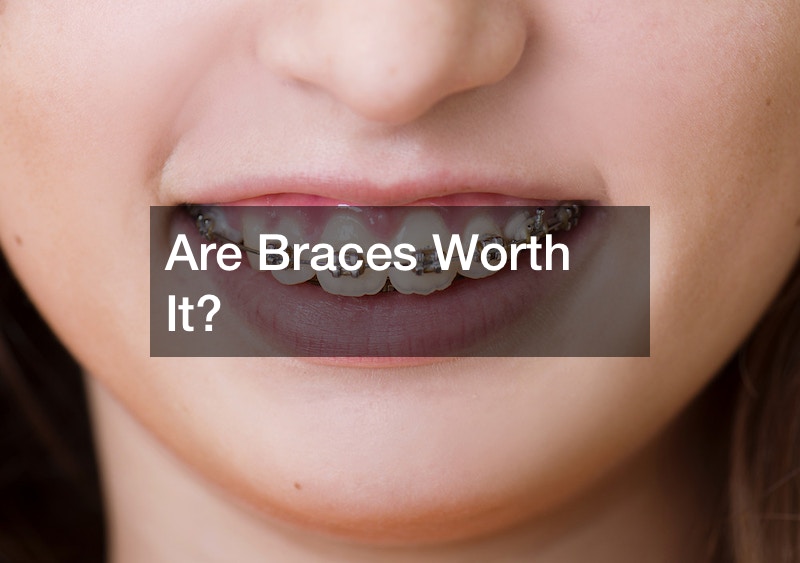 Are Braces Worth It?