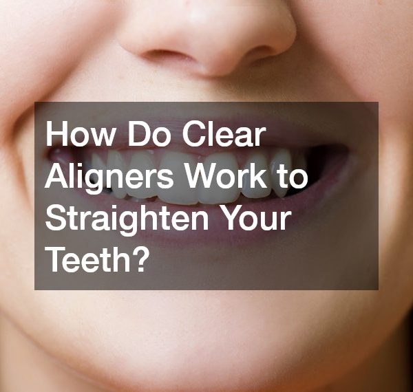 How Do Clear Aligners Work to Straighten Your Teeth?