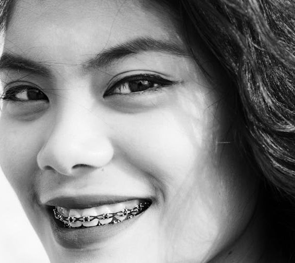 a woman wearing dental braces