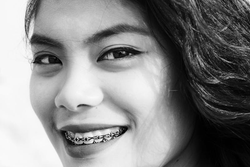 a woman wearing dental braces