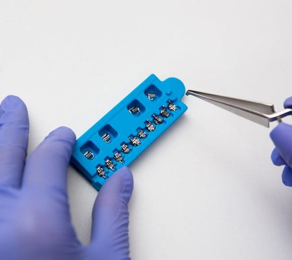 Types of Orthodontic Braces Explained in Simple Terms