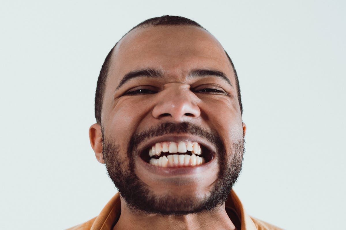 a man showing off his teeth